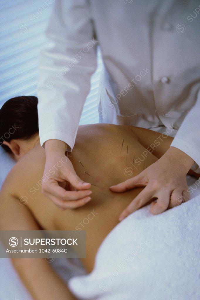 Stock Photo: 1042-6084C Mid adult woman getting an acupuncture treatment on her back