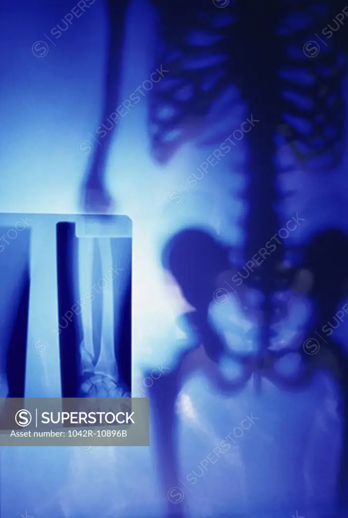 X-ray of a human skeleton