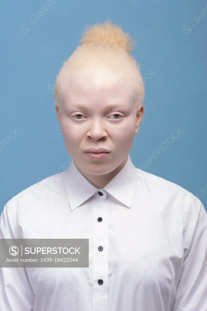 Studio portrait of albino woman in white shirt
