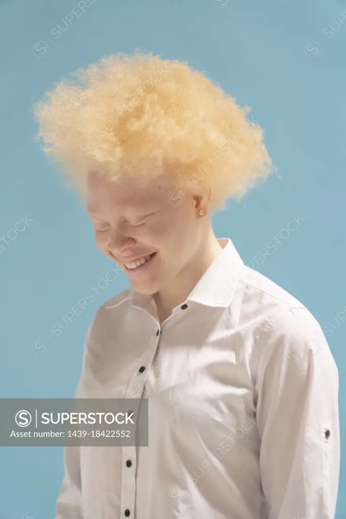 Studio portrait of smiling albino woman in white shirt