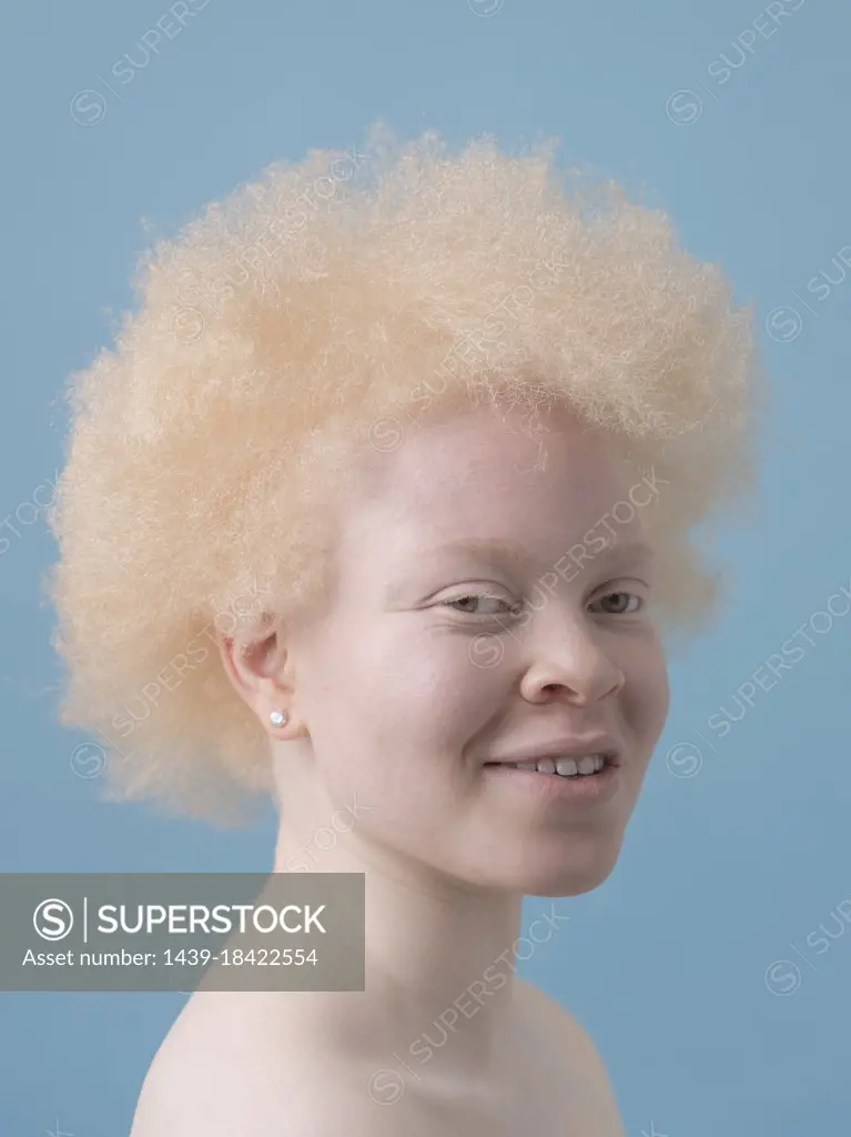 Studio portrait of smiling albino woman