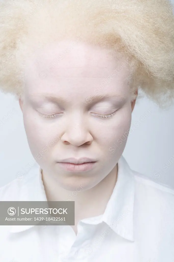 Close-up of albino woman with eyes closed