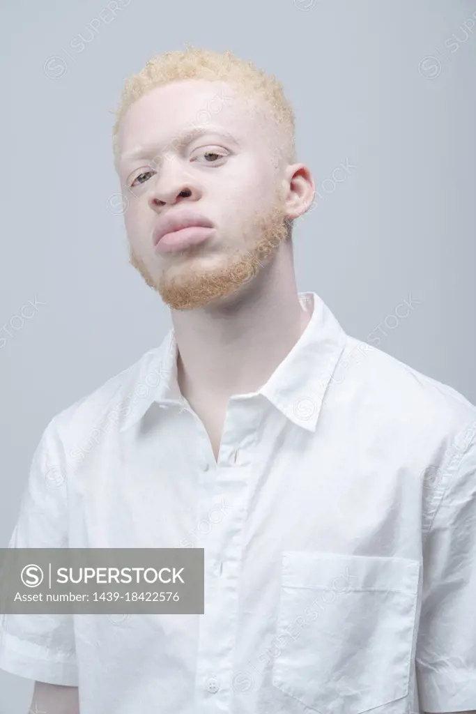Studio portrait of albino man in white shirt