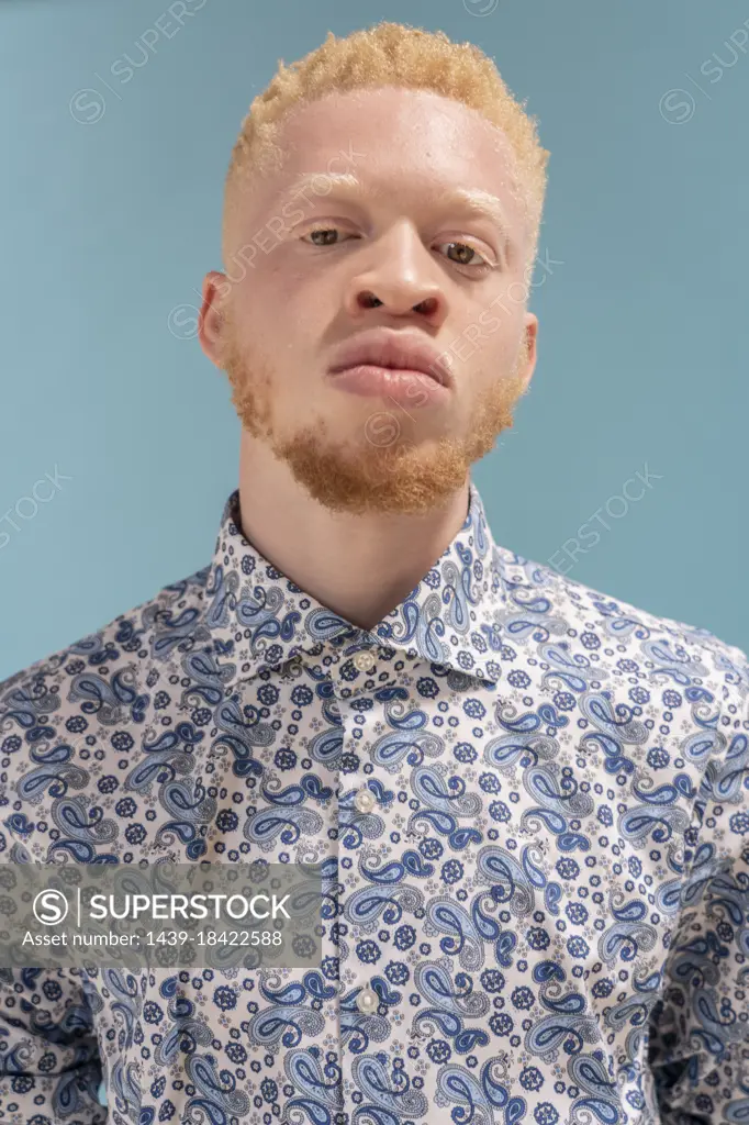Studio portrait of albino man in blue patterned shirt