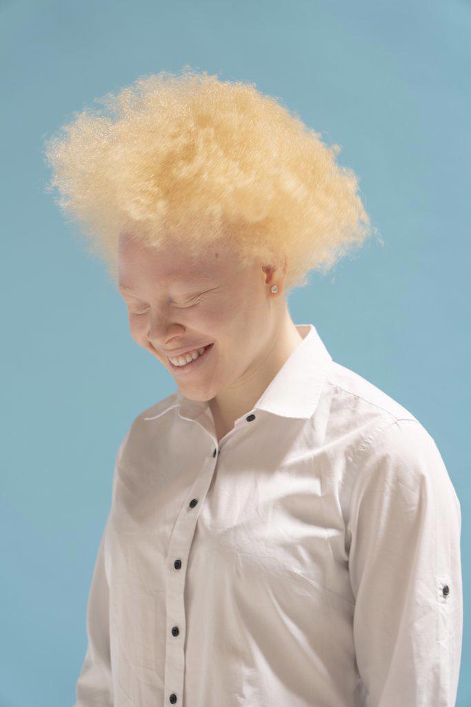 Studio portrait of smiling albino woman in white shirt