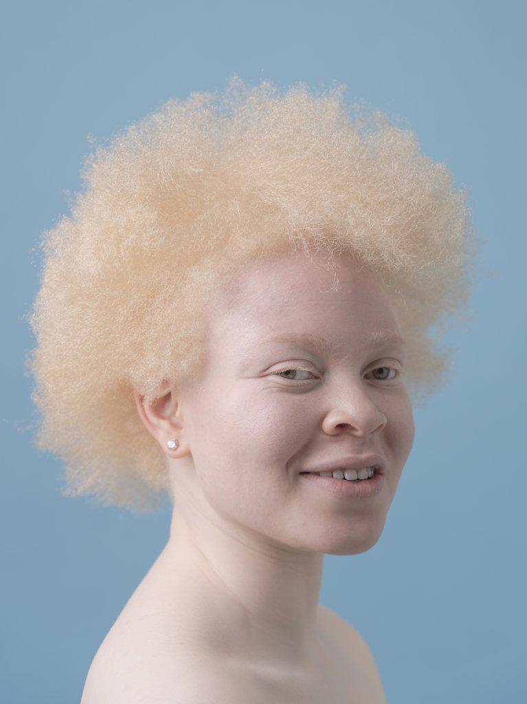 Studio portrait of smiling albino woman