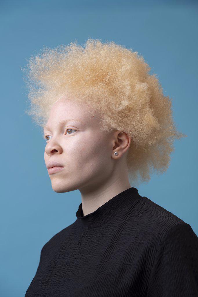 Studio portrait of albino woman