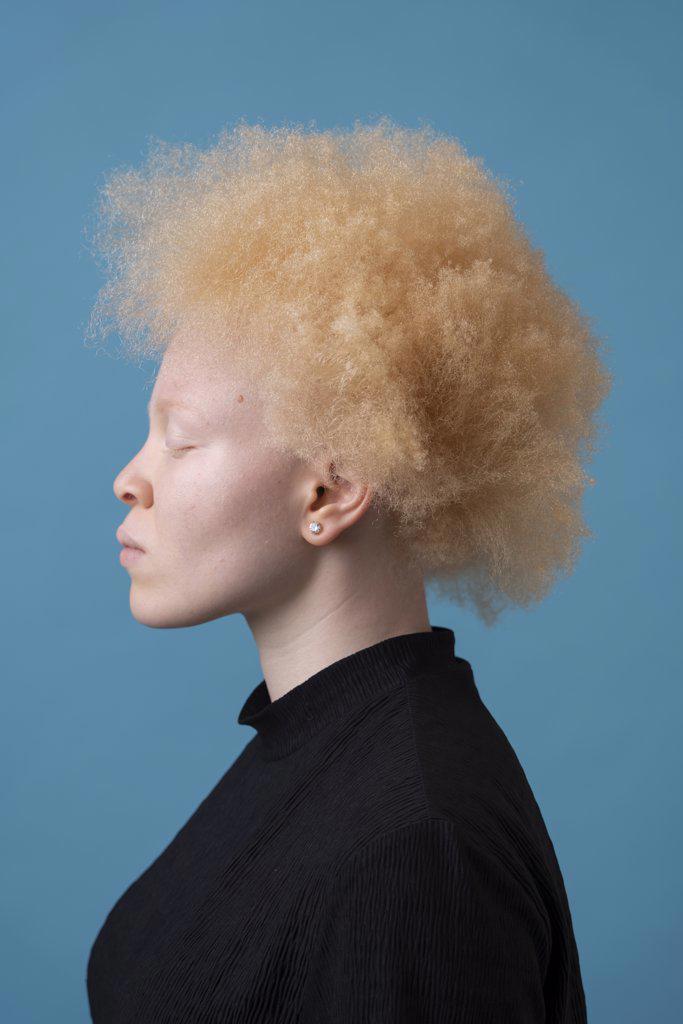 Studio portrait of albino woman with eyes closed