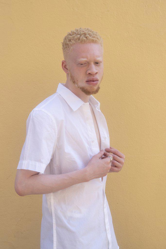 Germany, Cologne, Albino man in white shirt against yellow wall