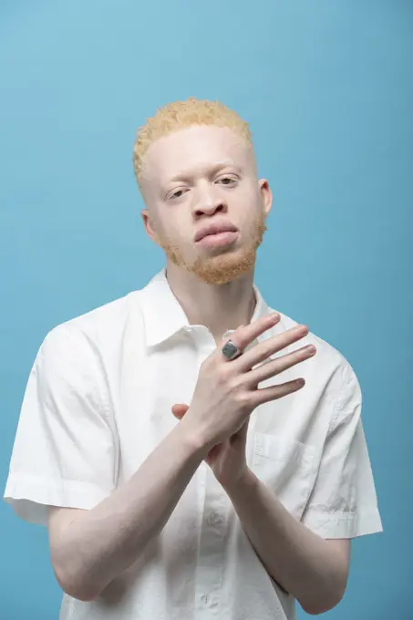 Studio portrait of albino man in white shirt