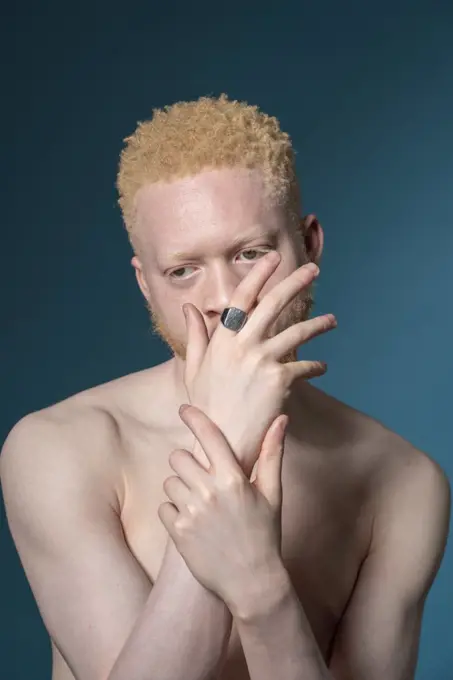 Studio portrait of shirtless albino man
