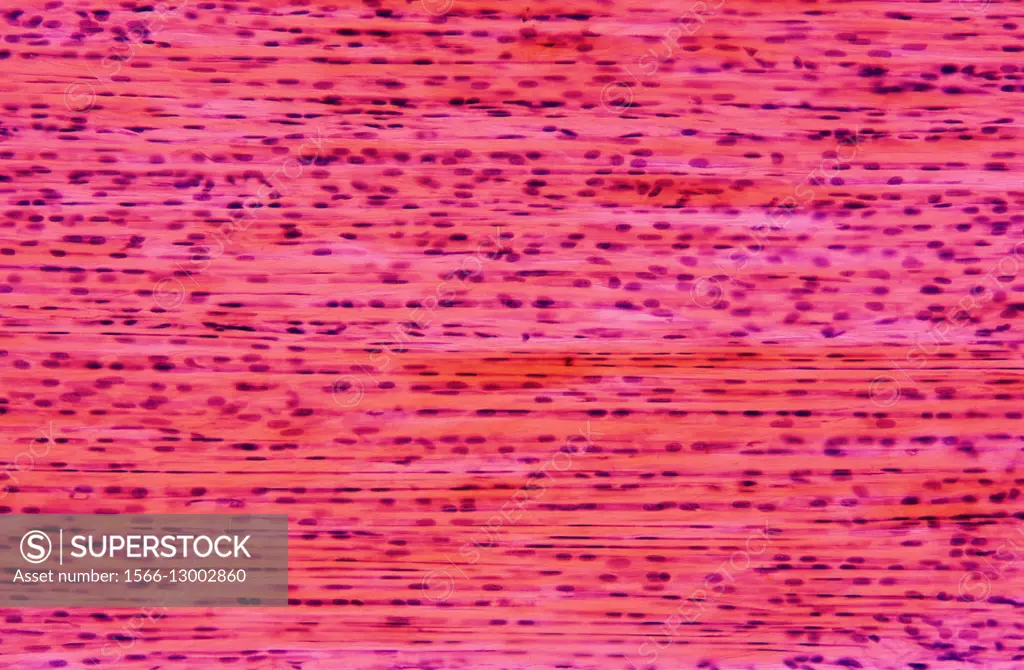 Dense connective tissue or dense fibrous tissue seen under light microscope X40. Is composed of collagen and fibroblats and form de tendons... - SuperStock