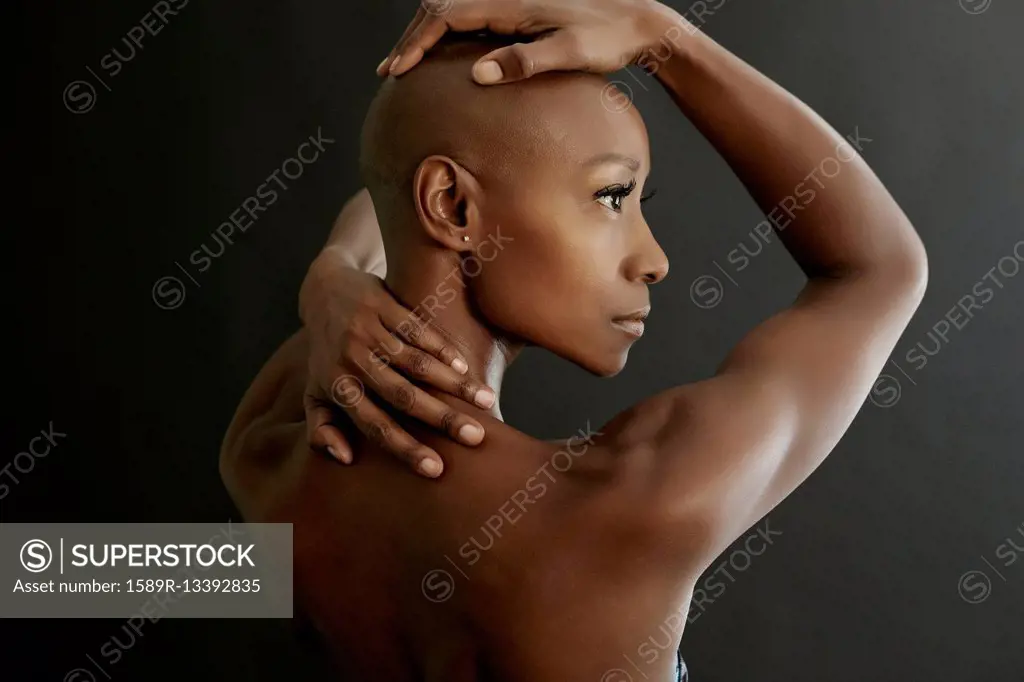 African American woman holding her bald head