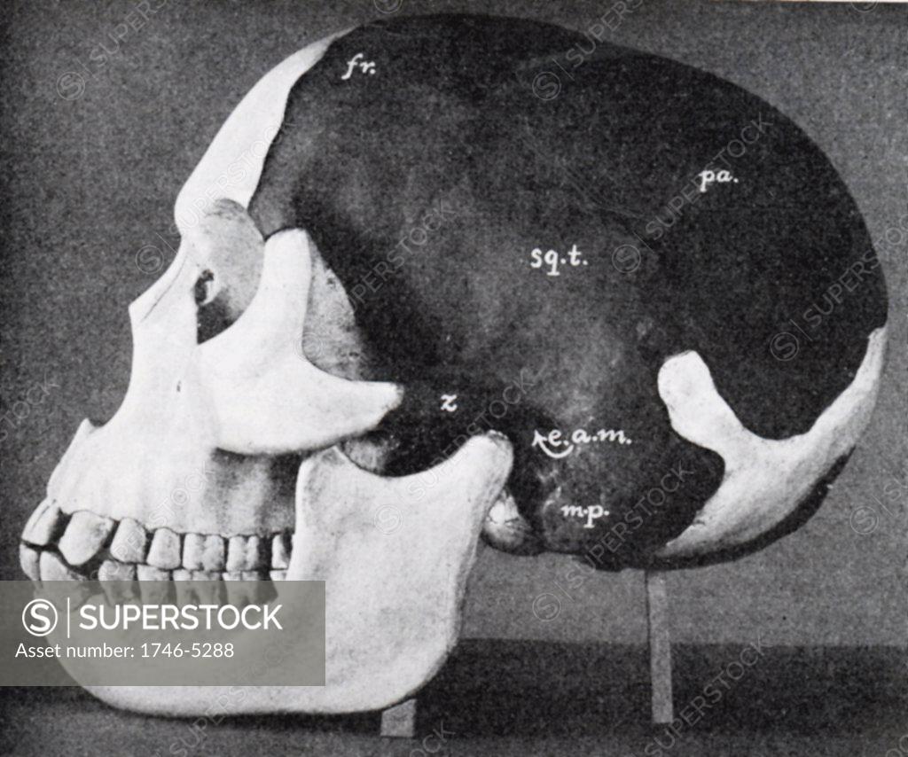 Stock Photo: 1746-5288 Model of skull of Piltdown man (Eanothropus dawsoni) as reconstructed by Dr Smith Woodward. Dark areas are from the original fossil, the light are the restored areas. Most of the lower jaw restored on far side. From Scientific American 7 November 1914.