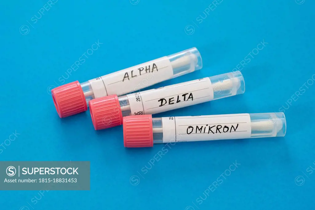 Swab tubes with medical samples on blue background