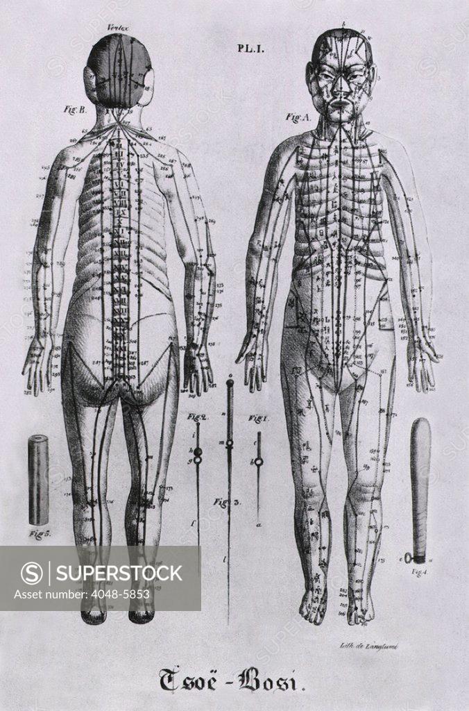 Stock Photo: 4048-5853 Front and back views of a human figure with numerous acupuncture points and meridians identified. Between the figures, but not to scale, are three acupuncture needles. Illustration from a 1825 French book on Chinese acupuncture by Jean Baptiste Sarlandiere.