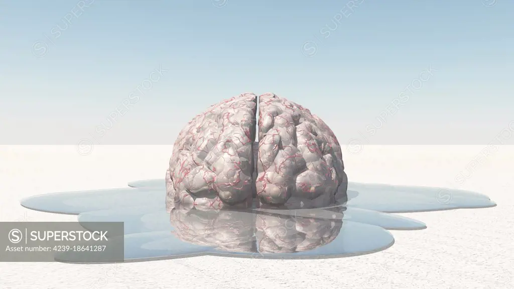 3D rendering of a human brain melting.