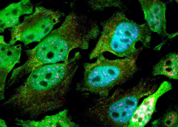 Immortal Cells:  HeLa Cells, Microscopic View