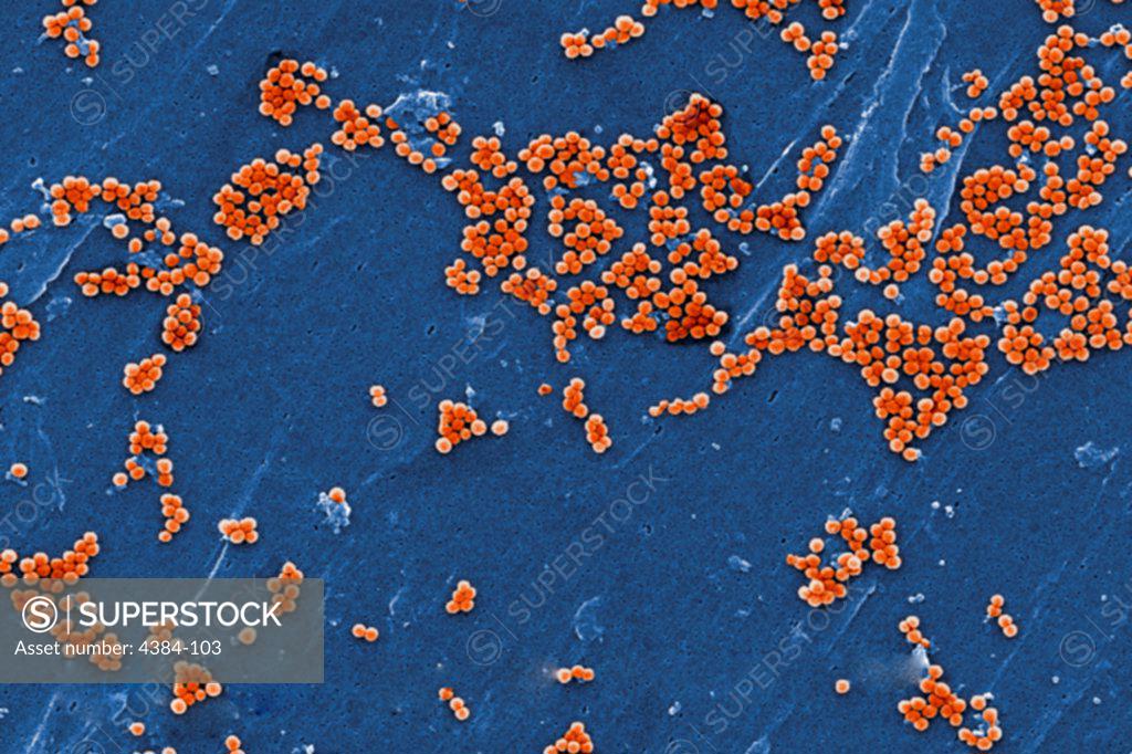 Stock Photo: 4384-103 This 2005 colorized scanning electron micrograph (SEM) depicted numerous clumps of methicillin-resistant Staphylococcus aureus  bacteria, commonly referred to by the acronym, MRSA; Magnified 4780. Recently recognized outbreaks, or clusters of MRSA in community settings have been associated with strains that have some unique microbiologic and genetic properties, compared with the traditional hospital-based MRSA strains, which suggests some biologic properties, e.g., virulence factors like toxins,