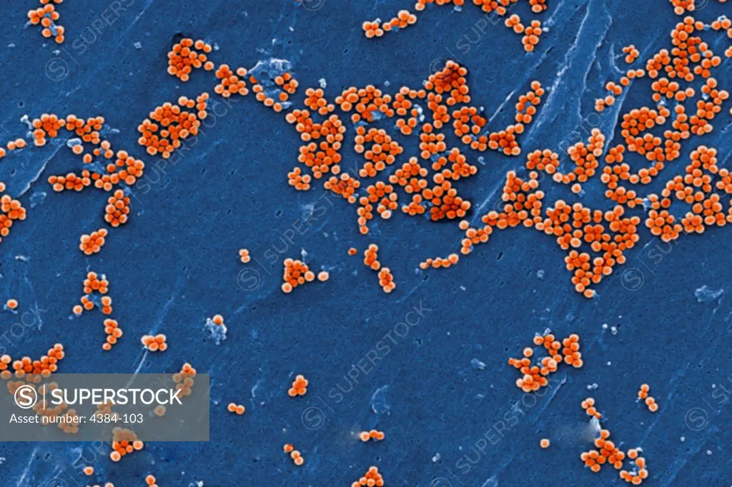 This 2005 colorized scanning electron micrograph (SEM) depicted numerous clumps of methicillin-resistant Staphylococcus aureus  bacteria, commonly referred to by the acronym, MRSA; Magnified 4780. Recently recognized outbreaks, or clusters of MRSA in community settings have been associated with strains that have some unique microbiologic and genetic properties, compared with the traditional hospital-based MRSA strains, which suggests some biologic properties, e.g., virulence factors like toxins,