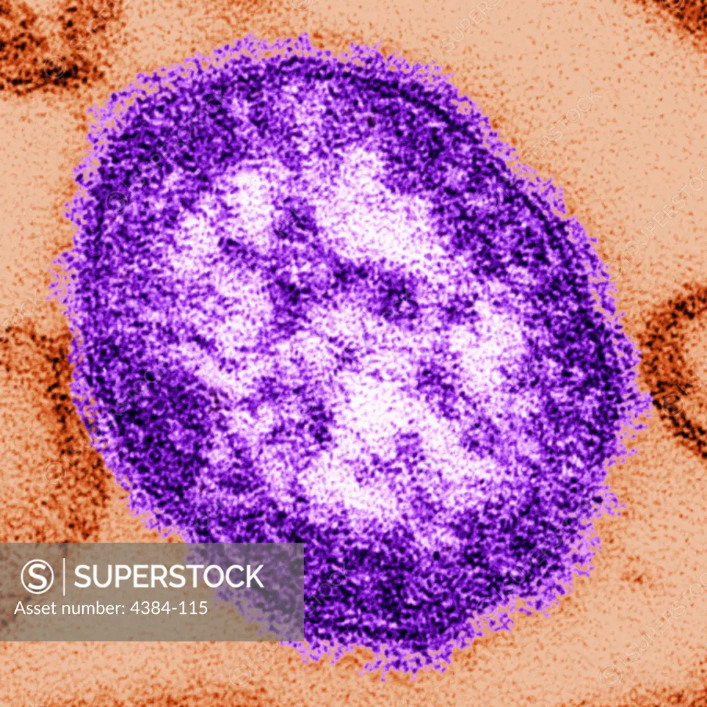 This thin-section transmission electron micrograph (TEM) revealed the ultrastructural appearance of a single virus particle, or ?virion?, of measles virus. The measles virus is a  paramyxovirus, genus  Morbillivirus. It is 100-200 nm in diameter, with a core of single-stranded RNA, and is closely related to the rinderpest and  canine distemper  viruses. Two membrane envelope proteins are important in pathogenesis. They are the F (fusion) protein, which is responsible for fusion of virus and host