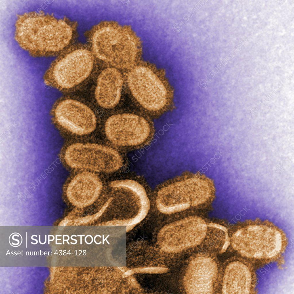 Stock Photo: 4384-128 This negative stained transmission electron micrograph (TEM) shows recreated 1918 influenza virions that were collected from supernatants of 1918-infected Madin-Darby Canine Kidney (MDCK) cells cultures 18 hours after infection. To separate these virions, the MDCK cells are spun down (centrifugation), and the 1918 virus in the fluid is immediately fixed for negative staining. The solid mass in lower center contains MDCK cell debris that did not spin down during the procedure. Dr. Terrence Tumpey