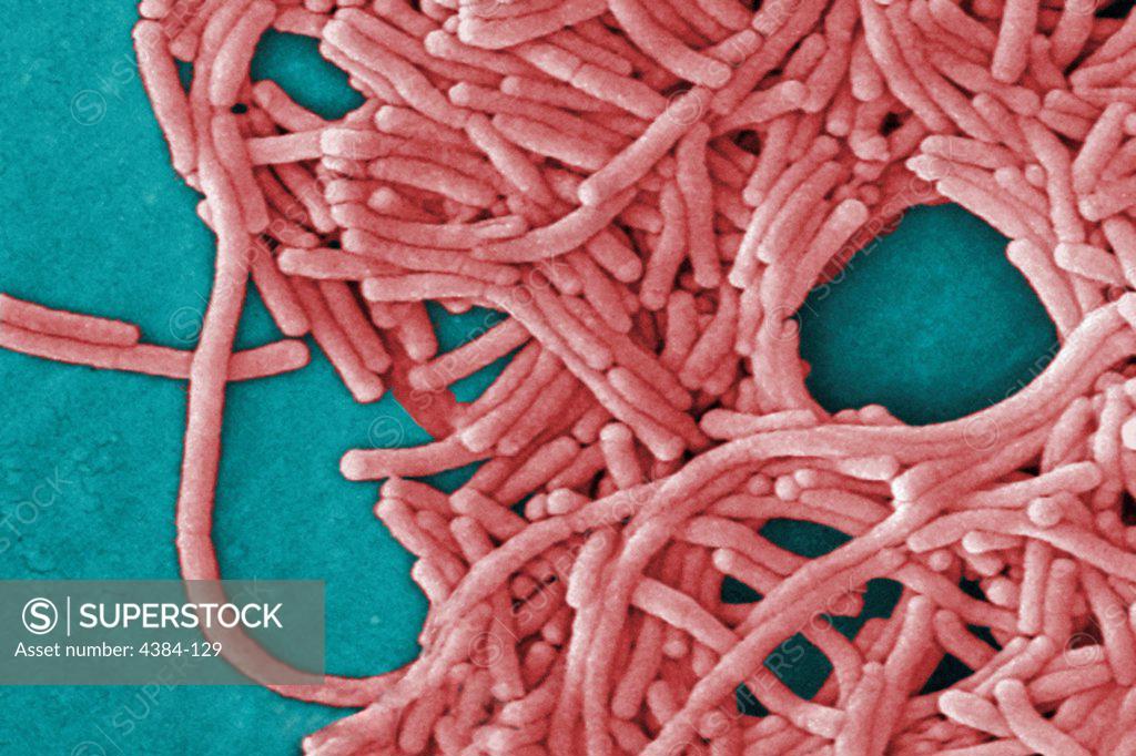 Stock Photo: 4384-129 Under a moderately-high magnification of 8000X, this colorized scanning electron micrograph (SEM) depicted a large grouping of Gram-negative Legionella pneumophila bacteria. Of particular importance is the presence of polar flagella, and pili, or long streamers, which due to their fragile nature, in some of these views seem to be dissociated from any of the bacteria. Note that a number of these bacteria seem to display an elongated-rod morphology.  L. pneumophila  are known to most frequently ex