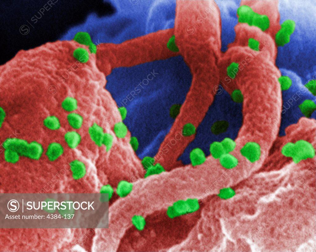 Stock Photo: 4384-137 This scanning electron micrograph revealed the presence of the human immunodeficiency virus (HIV-1), (spherical in appearance), which had been co-cultivated with human lymphocytes.