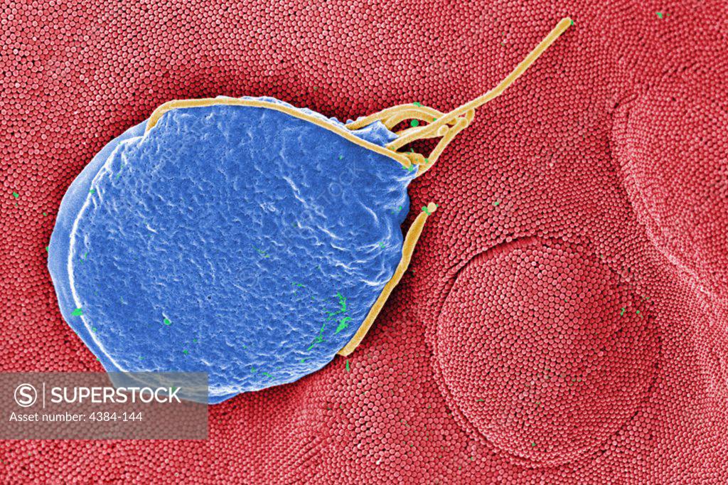 Stock Photo: 4384-144 This digitally-colorized scanning electron micrograph (SEM) depicted a Giardia muris protozoan adhering itself to the microvillous border of an intestinal epithelial cell.  Each small circular profile under the protozoan represents the rounded tip of a single microvillous, and it is estimated that 2000 to 3000 microvilli cover the surface of a single intestinal epithelial cell.  The two circular lesions on the right side of the photograph are impressions made by the ventral adhesive disk of othe