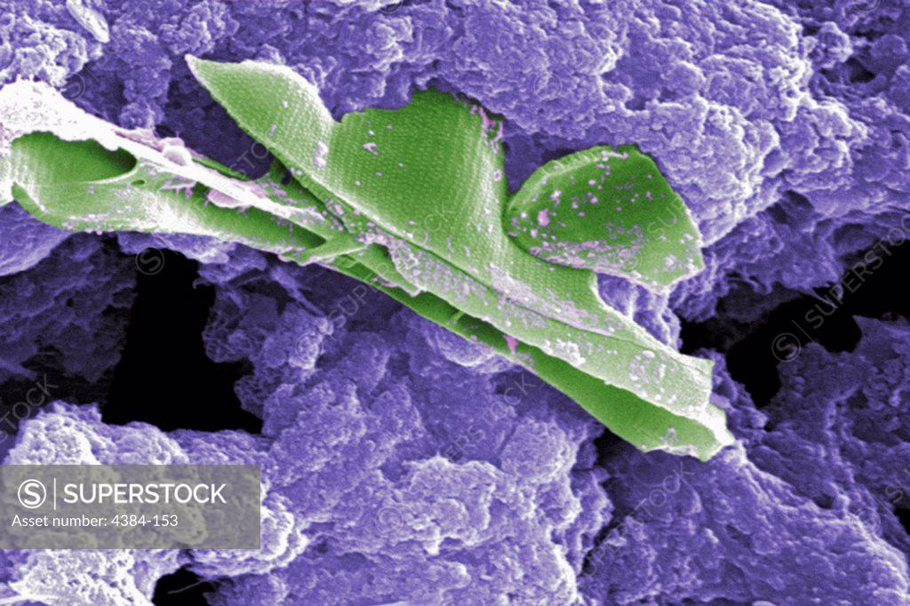 Stock Photo: 4384-153 This digitally-colorized scanning electron micrograph (SEM) of an untreated water specimen extracted from a wild stream mainly used to control flooding during inclement weather, revealed the presence of unidentified organisms, which included bacteria, protozoa, and algae. In this particular image, unidentified sheets of algae were wrapped in a mass of what appeared to be a mucoid amorphous biofilm. Though many organisms found in untreated waters are harmless, there are many that are pathogenic t