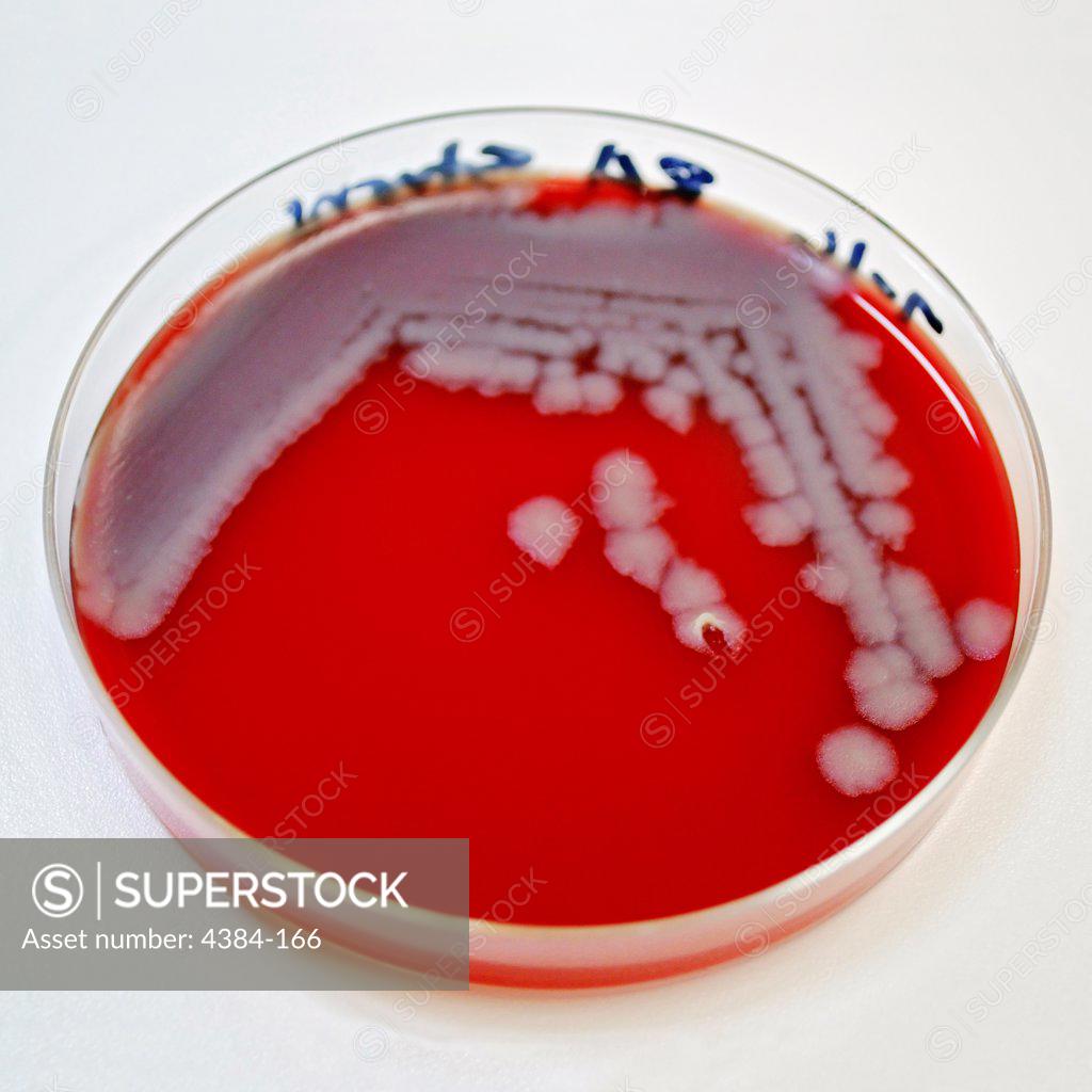 Stock Photo: 4384-166 Numbers of Bacillus anthracis bacterial colonies, which had been allowed to grow on sheep?s blood agar (SBA) for a 24 hour period. Note the classical appearance exhibited in the colonial morphology including a ground-glass, non-pigmented texture with accompanying ?comma? projections from some of the individual rough-edged colonies. There is evidence that a ?tenacity test? had been performed using an inoculating loop, which proved positive for  B. anthracis, causing the ?colony to ?stand up? like
