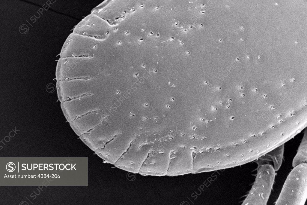 Stock Photo: 4384-206 Under a low magnification of 49X, this scanning electron micrograph (SEM) depicted a dorsal view of an unidentified male  tick (Dermacentor  sp.) found upon a cat in the suburbs of Decatur, Georgia, which measured approximately 3.5mm from its mandibulae to the distal abdominal margin. Note that the entire dorsum of this tick?s abdomen is covered by its tough ?scutum?, or ?shield?, categorizing it as a male, whereas, in female Ixodid-species ticks, the scutum only partially covers the dorsal abdo