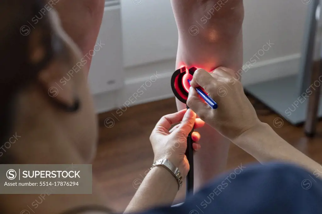 a doctor looks for varicose veins in a patient