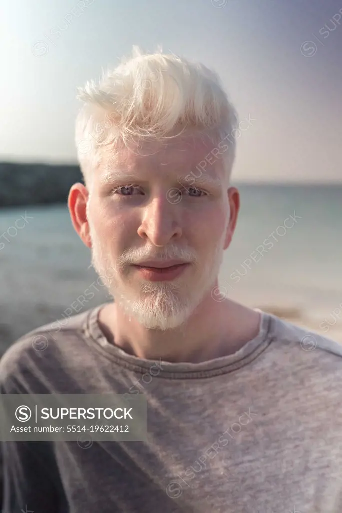 Albino man portrait by the beach looking at the camera