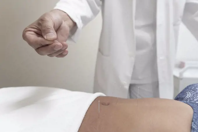 a doctor doing acupuncture puts a needle in a patient's stomach