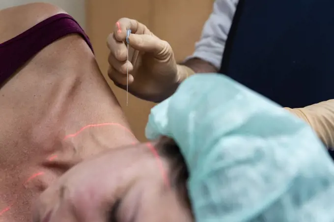a doctor is looking for a site to inject pain relief