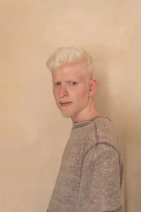 Albino man standing by the wall portrait